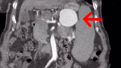 Şırnak’ta, Kalp ve Damar Cerrahisi Uzmanı Op. Dr. Volkan Burak