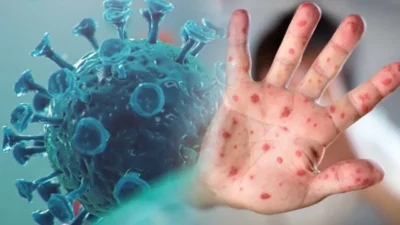 Gaziantep Özel Anka Hastanesi Enfeksiyon Hastalıkları ve Mikrobiyoloji Uzm. Dr.