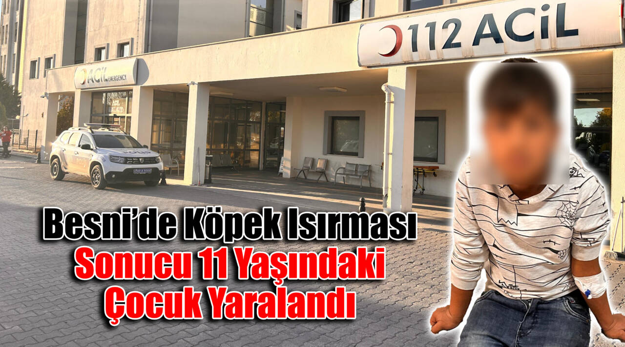 Besni’de Köpek Isırması Sonucu 11 Yaşındaki Çocuk Yaralandı