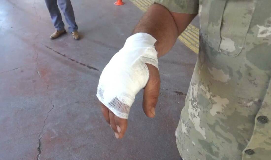 Şanlıurfa’da bayramın ilk gününde 176 acemi kasap hastanelere başvurdu.