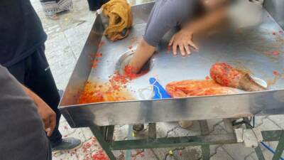 16 yaşındaki kız çocuğu, salça makinesine elini kaptırdı. İtfaiye ekipleri