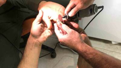 Mardin'in Derik ilçesinde bir vatandaşın parmağına sıkışan yüzük, hastanede itfaiye