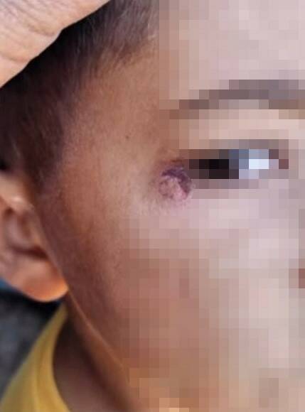 Öğrencinin yüzünde sigara söndüren temizlik görevlisi tutuklandı Şanlıurfa'nın Harran ilçesinde bir okulda temizlik görevlisi tarafından öğrenciye şiddet