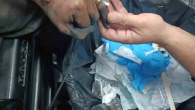 Batman'da bir vatandaşın parmağına sıkışan yüzük, 112 Acil Çağrı Merkezi'ne