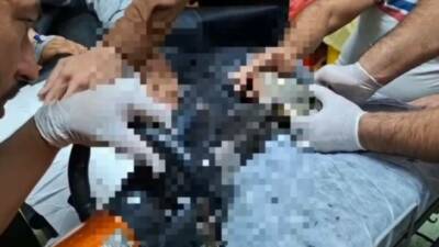 Tel Abyad kentinde kıyma makinesine eli sıkışan 8 yaşındaki çocuk,