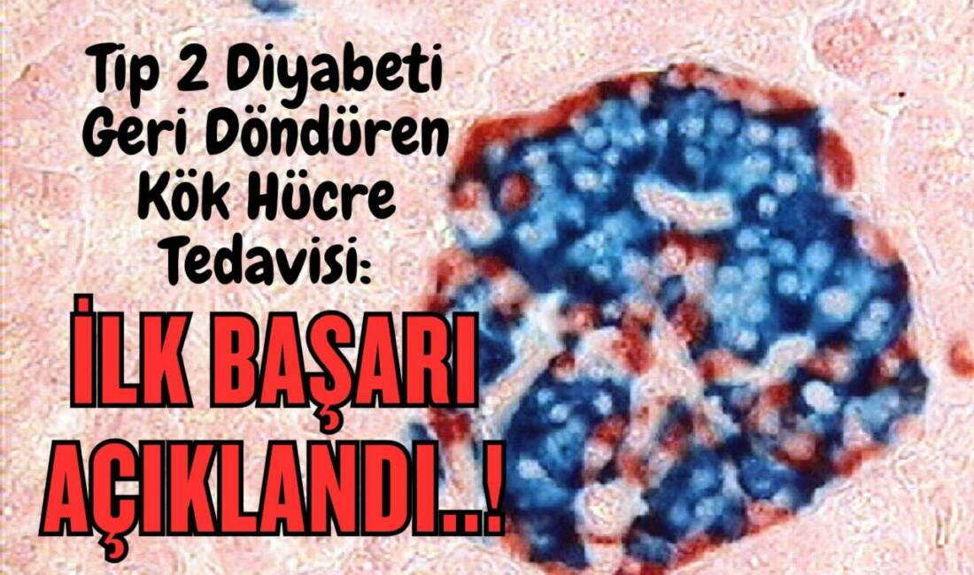 Tip 2 Diyabeti Geri Döndüren Kök Hücre Tedavisi: İlk Başarı Açıklandı..! Bilim insanları, 25 yıllık Tip 2 diyabet vakasında kök hücre