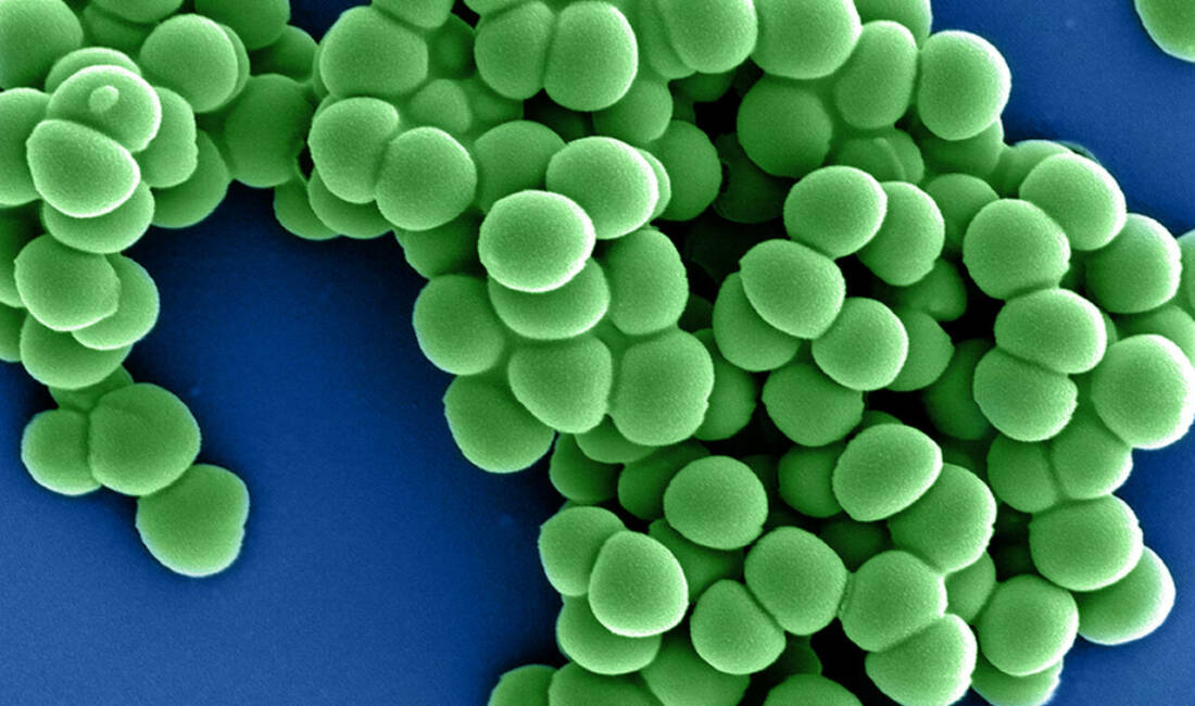 MIT ve Broad Enstitüsü araştırmacıları, yapay zekâ destekli bir sistemle