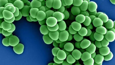 MIT ve Broad Enstitüsü araştırmacıları, yapay zekâ destekli bir sistemle