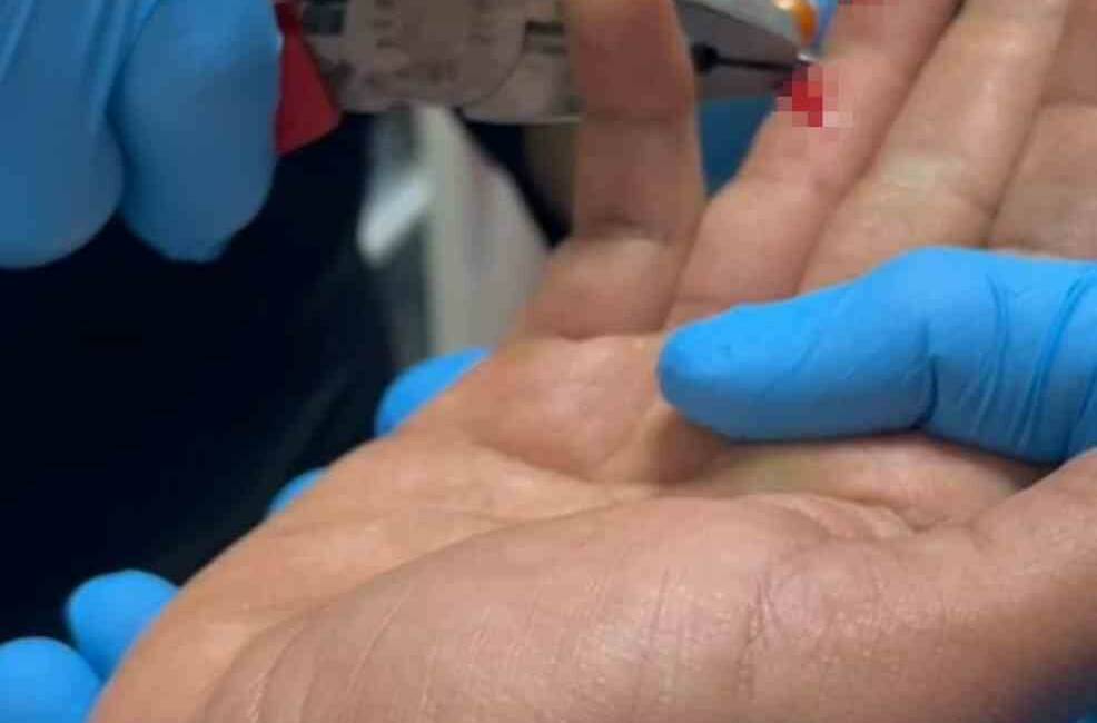 Adıyaman’ın Kahta ilçesinde balık avlamaya giden bir kişinin parmağına saplanan