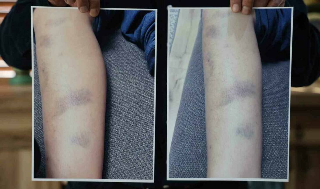 Diyarbakır'daki özel bir okulda 8 yaşındaki bir çocuğun darbedildiği iddiası