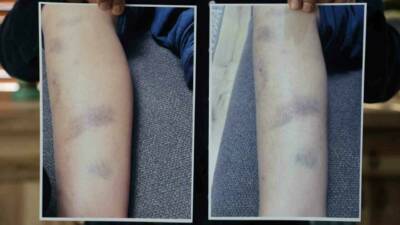 Diyarbakır'daki özel bir okulda 8 yaşındaki bir çocuğun darbedildiği iddiası