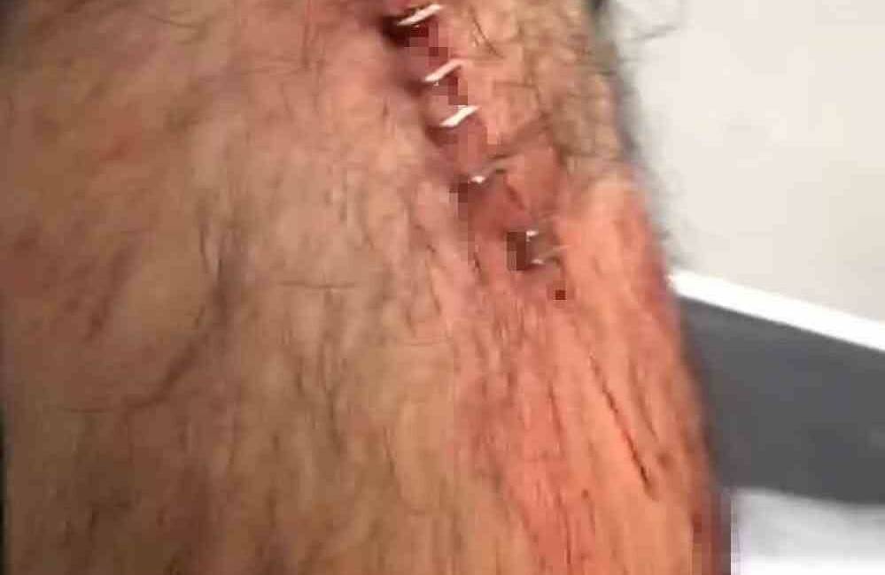 Şanlıurfa’nın Karaköprü ilçesinde görev yapan bir öğretmen, aracını park ettiği