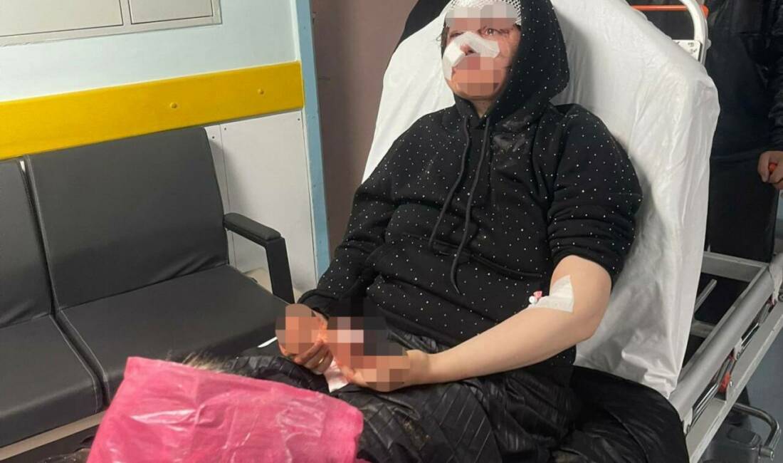 Gaziantep’te boşanmak isteyen karısını adliye önünde darp eden koca, sevk