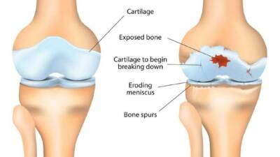 ABD’de Stanford University bünyesinde çalışan bilim insanları, diz ve kalça