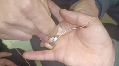 Adıyaman’da parmağına taktığı yüzük nedeniyle zor anlar yaşayan vatandaşın imdadına