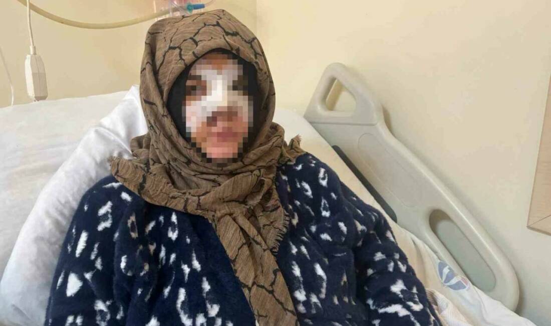 Gaziantep’te boşanmak isteyen eşini, kafası ve yüzüne taşla vurarak darp