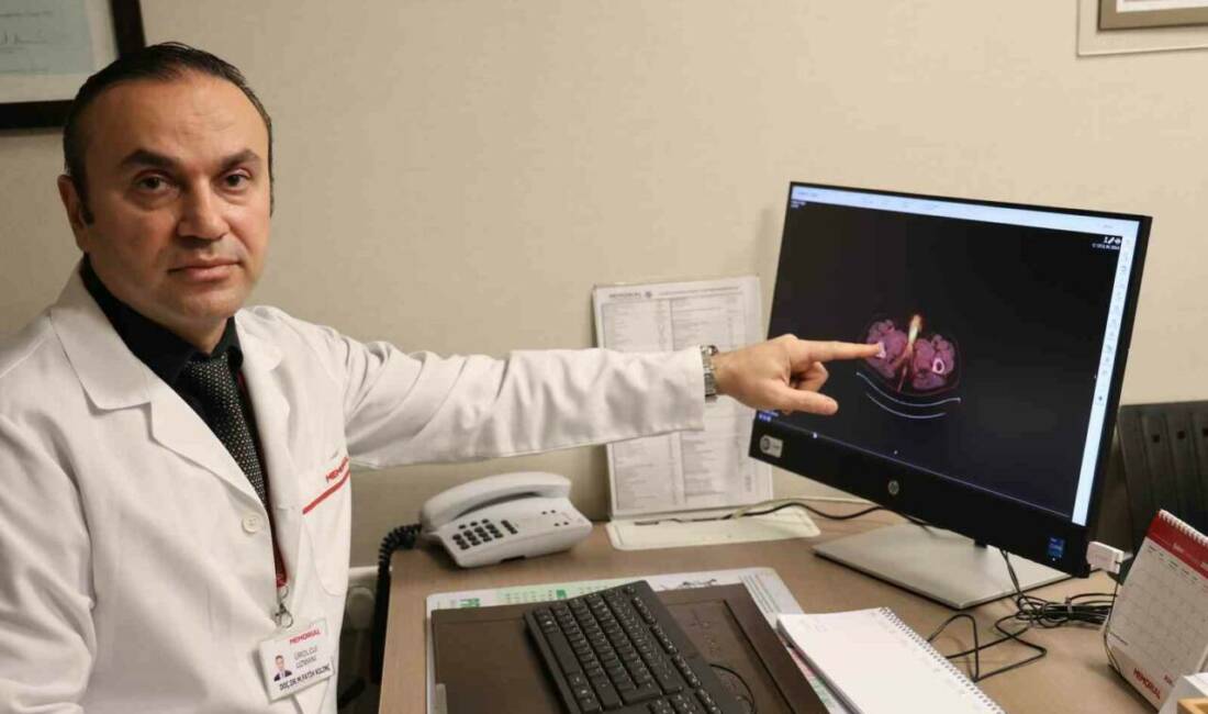 Diyarbakır’da yaşayan 38 yaşındaki hasta, kolon kanseri tedavisi görürken, ileri