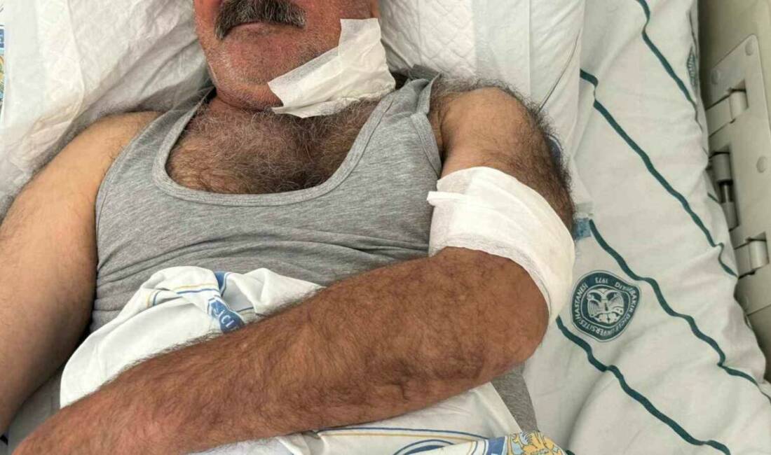 Diyarbakır’ın merkez Sur ilçesinde, bir kişi, at tarafından boğazından ısırılması