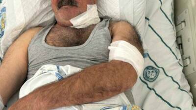 Diyarbakır’ın merkez Sur ilçesinde, bir kişi, at tarafından boğazından ısırılması