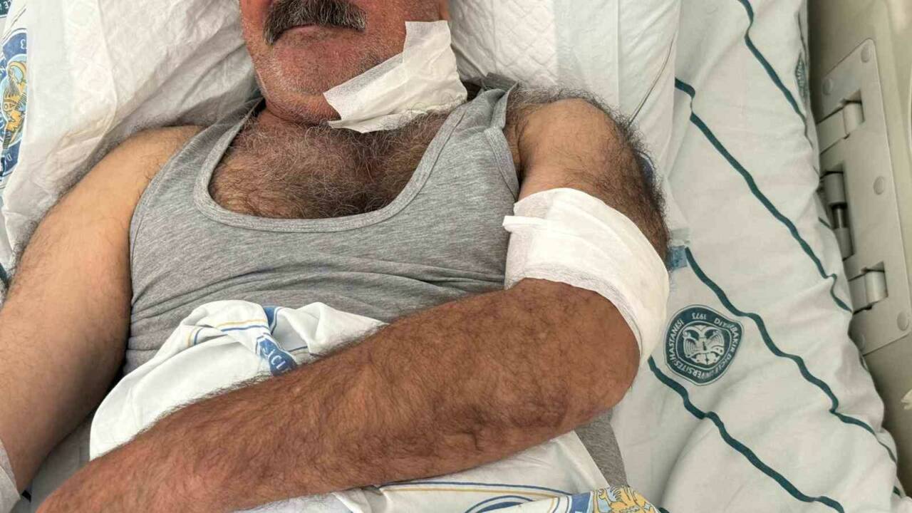 Diyarbakır’ın merkez Sur ilçesinde, bir kişi, at tarafından boğazından ısırılması