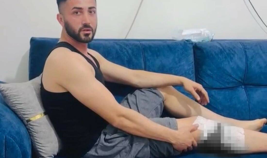 Gaziantep’in Nizip ilçesinde sokakta köpek saldırısına uğrayan 2 kişi ayaklarından