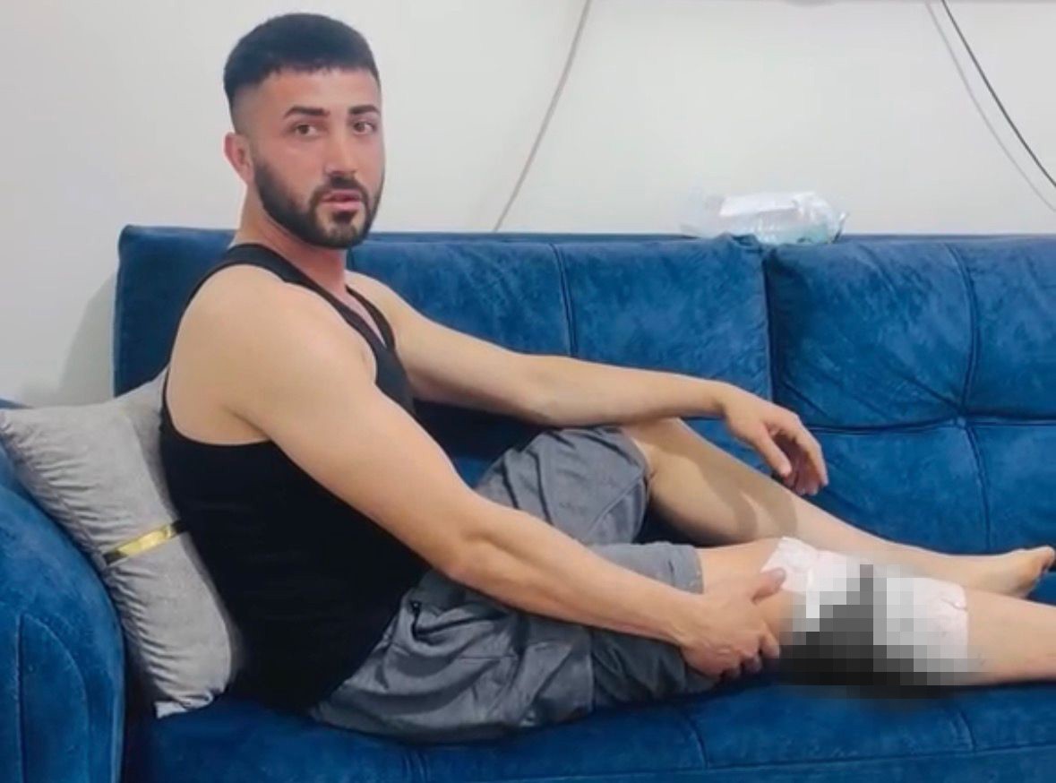 Gaziantep’in Nizip ilçesinde sokakta köpek saldırısına uğrayan 2 kişi ayaklarından