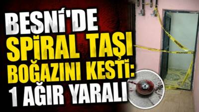 Adıyaman’da bir işçi kesim esnasında spiral taşının kırılarak boğazını kesmesi