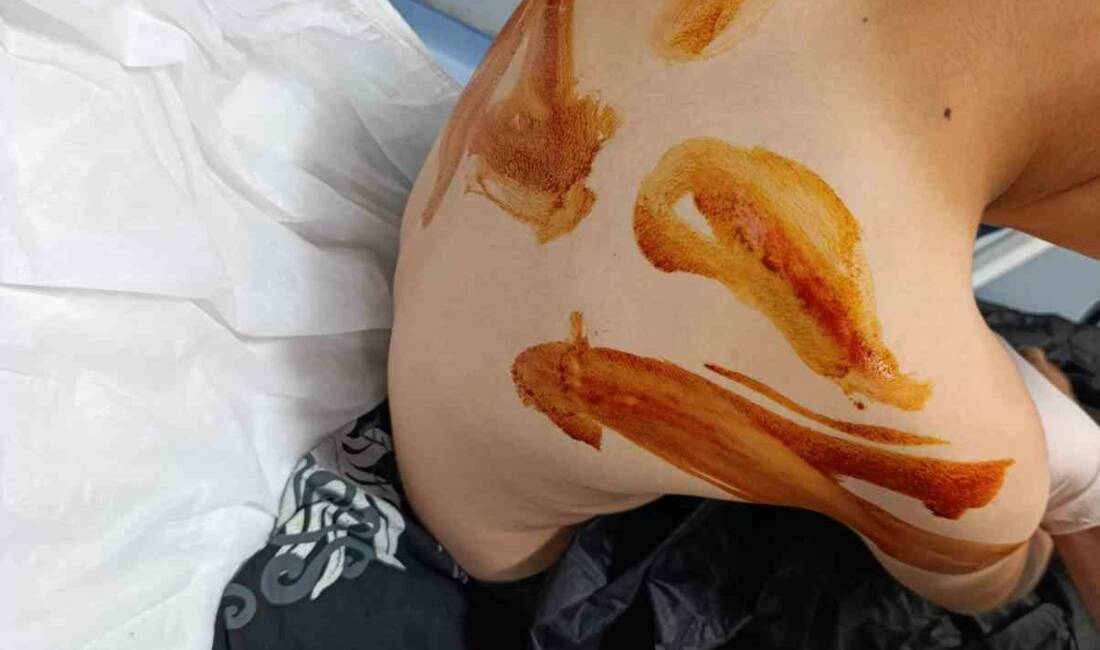 Şanlıurfa’nın Eyyübiye ilçesinde 17 yaşındaki çocuk, 11 yaşındaki komşusunu sopayla