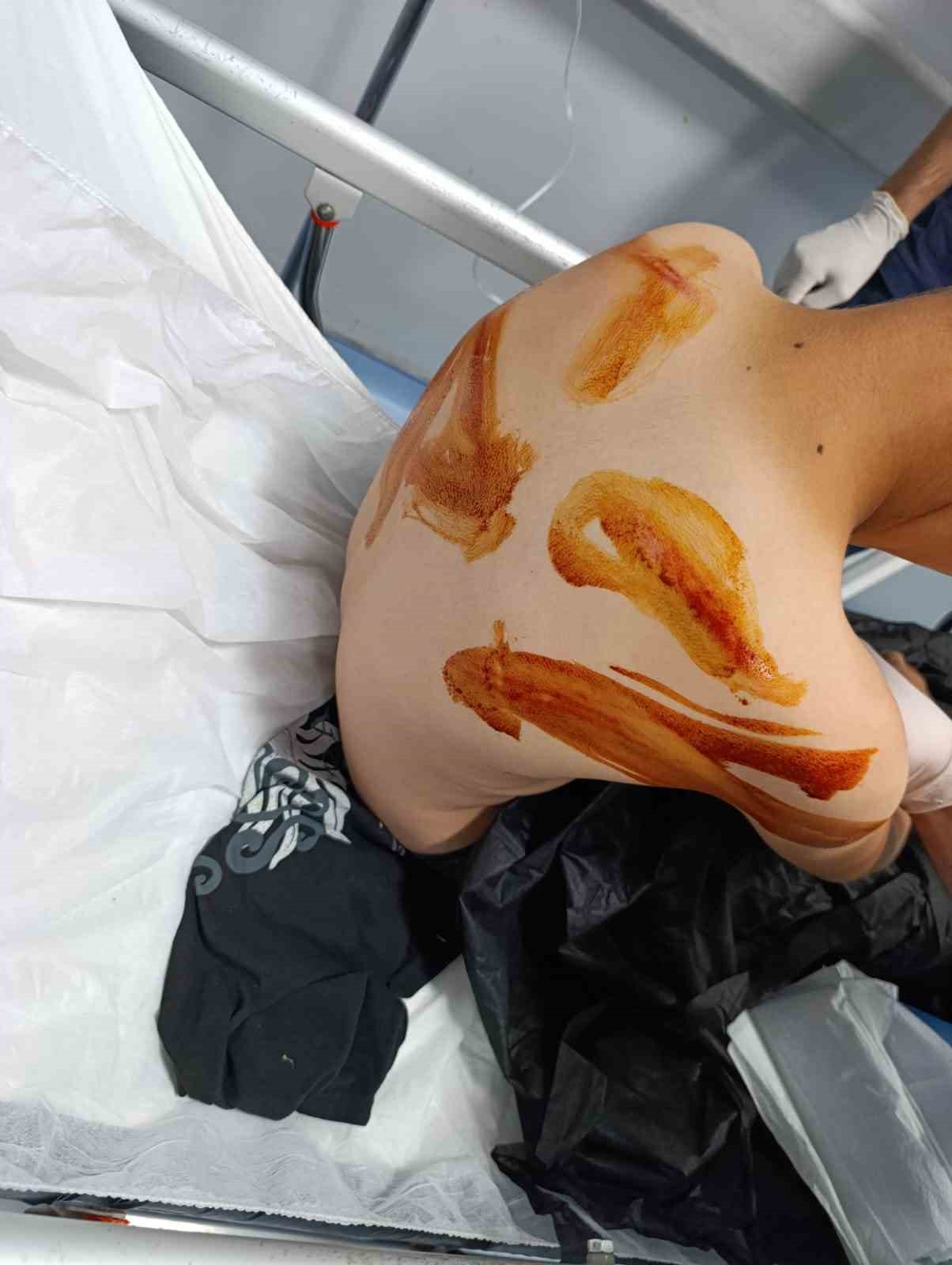 Şanlıurfa’nın Eyyübiye ilçesinde 17 yaşındaki çocuk, 11 yaşındaki komşusunu sopayla