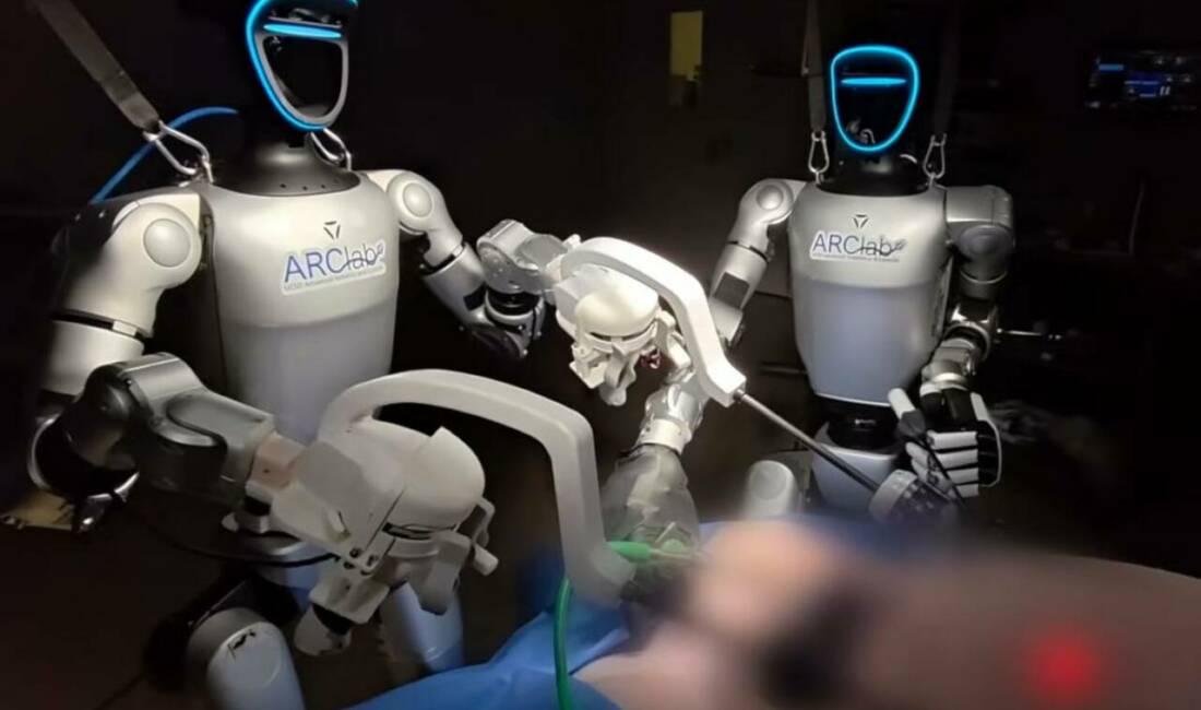 Dünyada Bir İlk: İnsansı Robot Başarıyla Ameliyat Yaptı ABD'de gerçekleştirilen bilimsel çalışmada bir insansı robot, laparoskopik safra kesesi