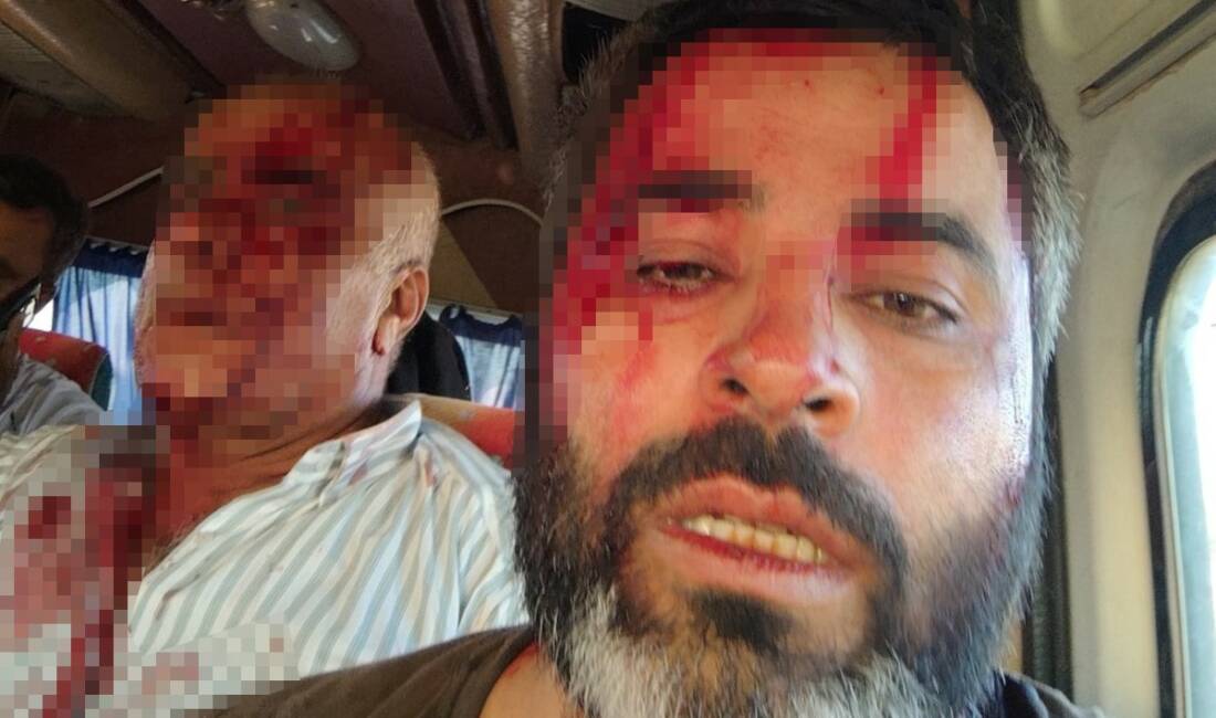 Şanlıurfa’nın Akçakale ilçesinde arazi anlaşmazlığı nedeniyle iki grup arasında çıkan