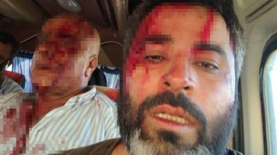 Şanlıurfa’nın Akçakale ilçesinde arazi anlaşmazlığı nedeniyle iki grup arasında çıkan