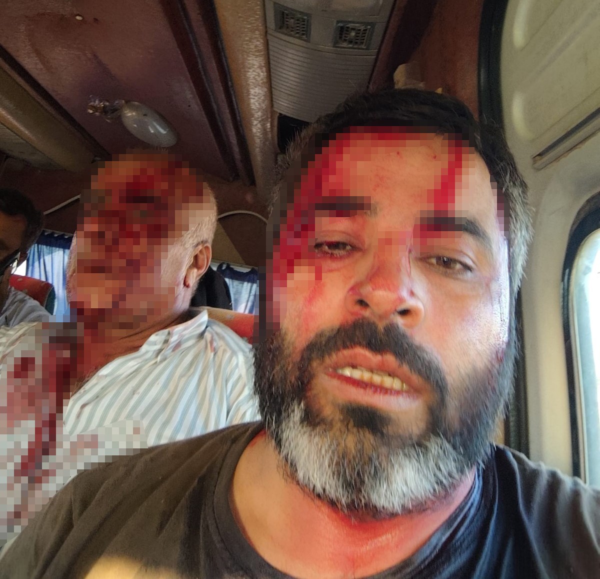 Şanlıurfa’nın Akçakale ilçesinde arazi anlaşmazlığı nedeniyle iki grup arasında çıkan