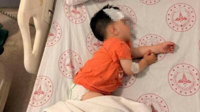 Şanlıurfa’da başıboş sokak köpeklerinin saldırdığı 1 buçuk yaşında çocuk yaralandı.