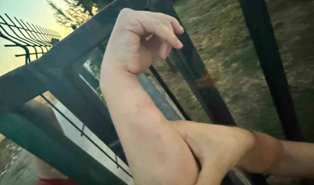 Batman’da kolunu bahçe girişindeki demir korkuluklara sıkıştıran bir vatandaş, itfaiye